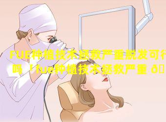 FUE种植技术拯救严重脱发可行吗「fue种植技术拯救严重 🕸 脱发可行吗」